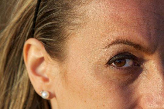 Borse sotto gli occhi